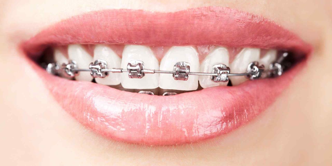 ¿Cómo puede durar el esmalte dental toda la vida?